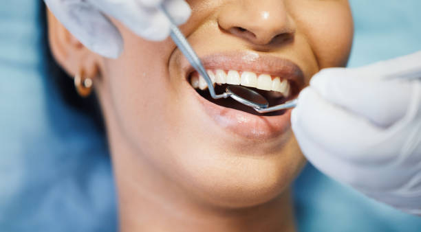 Best Emergency Dental Care for Abscessed Tooth in Sterling, AK